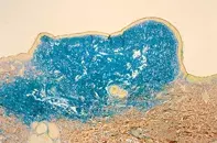 Fig 3. Colloidal iron stain Fig 3. Colloidal iron stain