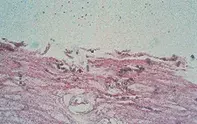 Fig 2. Pigmented spores