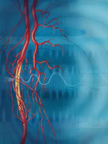  © SCIENCE SOURCE/DNA ILLUSTRATIONS/DIOMEDIA.COM